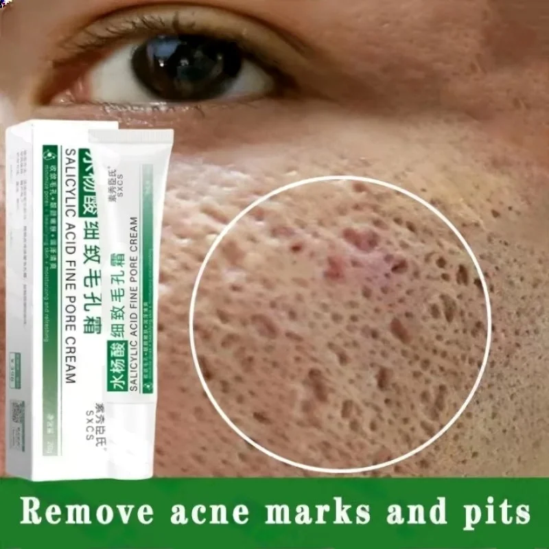 Korean Skincare Routine - Krim Pembersih Pori Asam Salisilat Mengecilkan