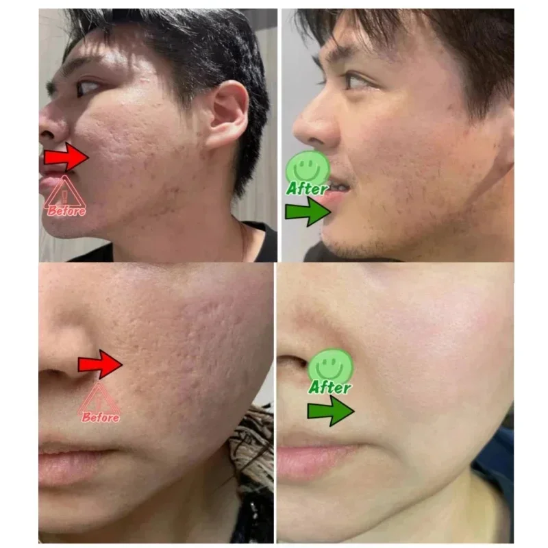 Krim Pembersih Pori Asam Salis - Korean Skincare Routine ulasan dan harga