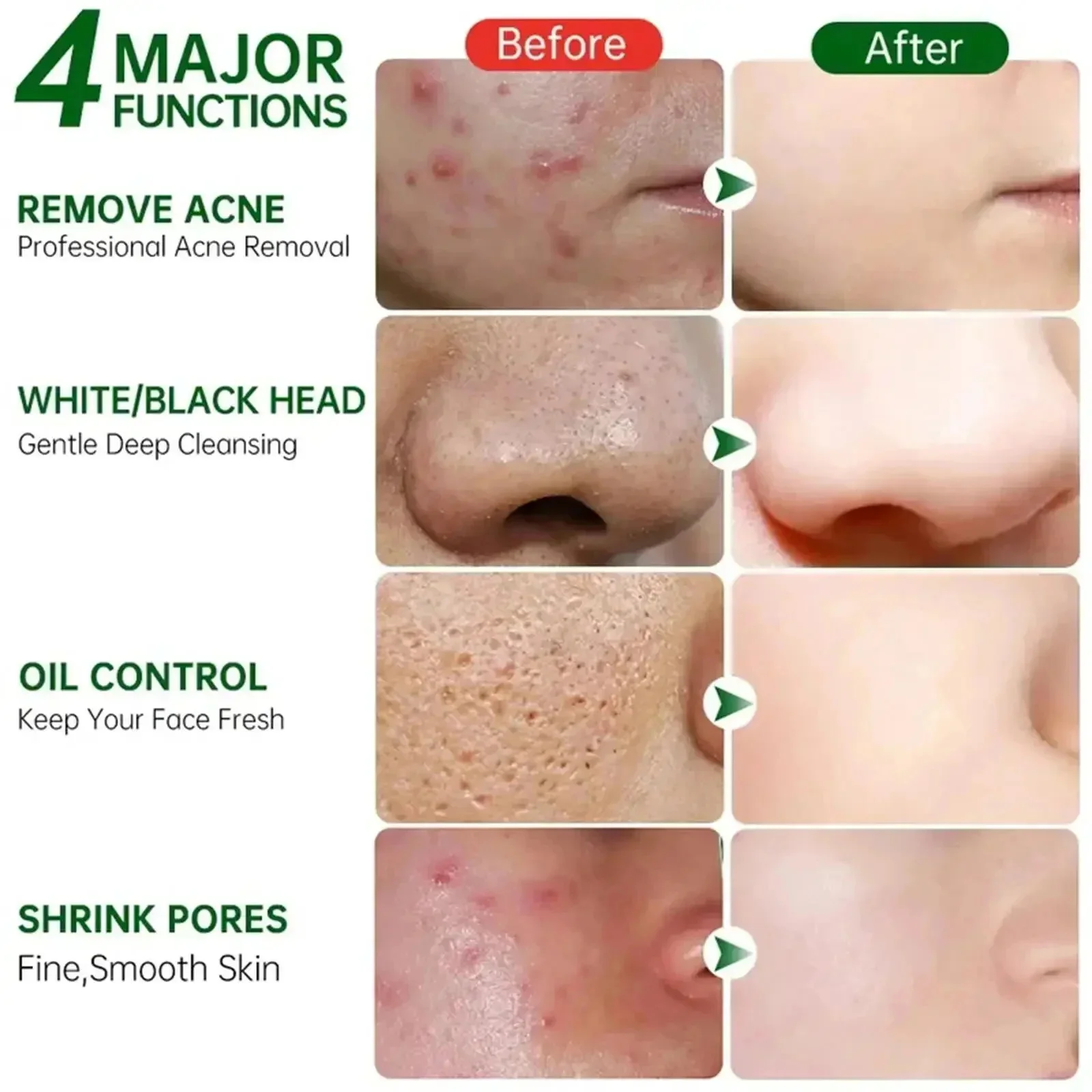 Krim Pembersih Pori Asam Salis - Korean Skincare Routine ulasan dan harga