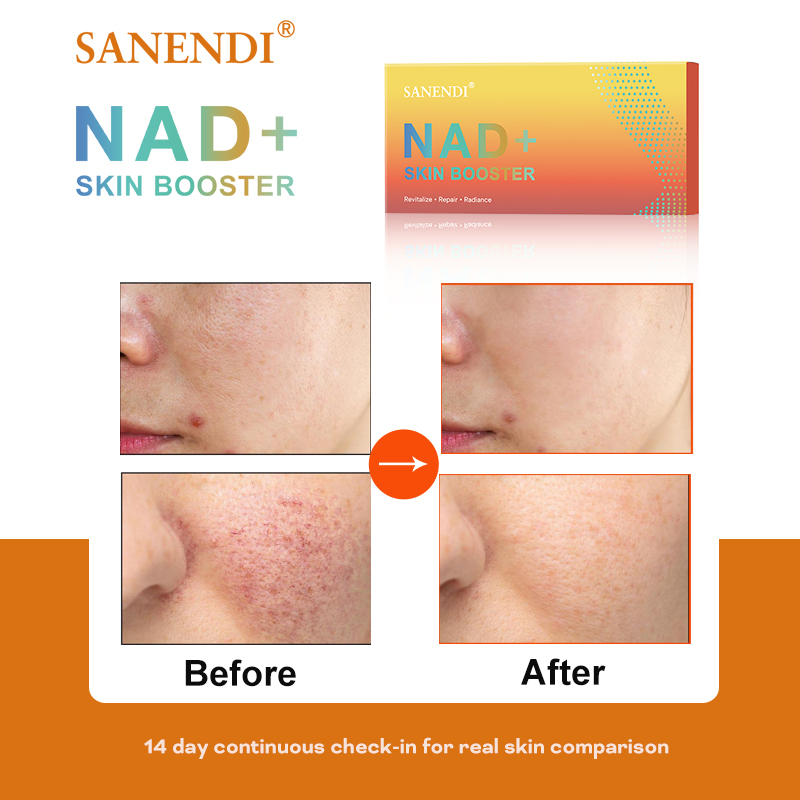 Sanendi NAD+ Korea Produk Pera - Korean Skincare Routine ulasan dan harga